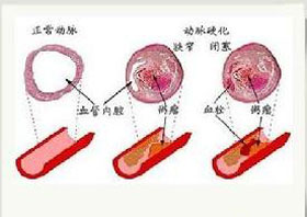 概述