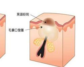 症状描述