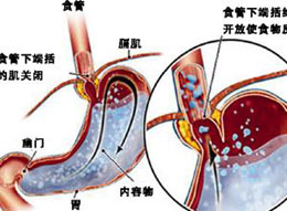 概述