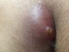 症状起因