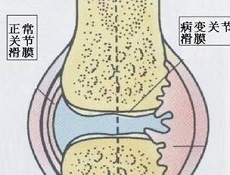 临床症状