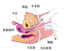 疾病简介