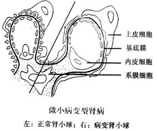 综合症