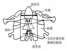 症状诊断/鉴别