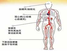 症状诊断/鉴别