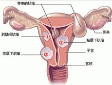 高危因素