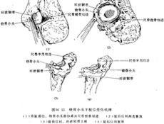 鉴别诊断