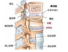 颈椎病严重