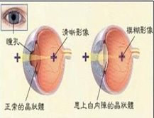 症状诊断/鉴别