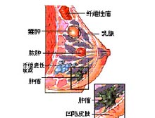 症状诊断/鉴别