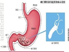 诊查要点