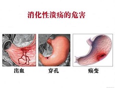 病理生理