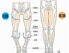 诊断要点