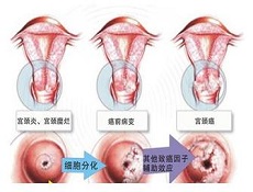 并发症