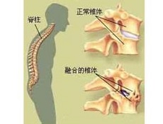 鉴别诊断