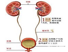 注意事项