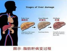 疾病治疗