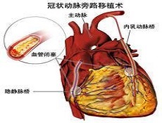 微治疗法