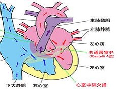 成人室缺的全解