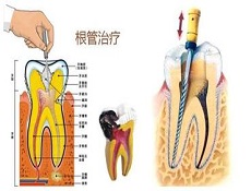 治疗