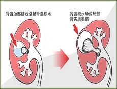 诊断鉴别