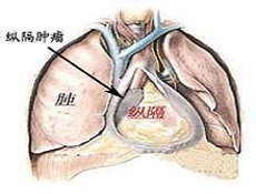 临床表现