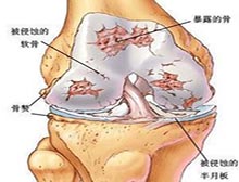 症状起因