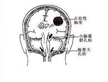 症状描述