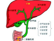 疾病简介