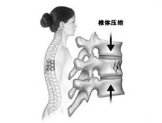 并发症