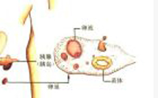 治疗方案