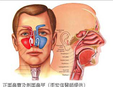 鼻窦炎
