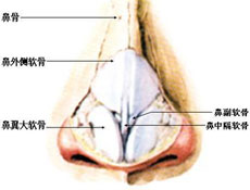 鼻中隔偏曲