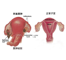 疾病分类