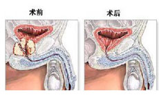 疾病分类