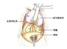 临床表现