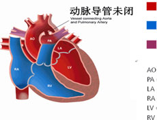 治疗