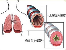 治疗方法