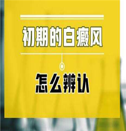 南京治白癜风哪家医院好？白斑有哪些症状表现？