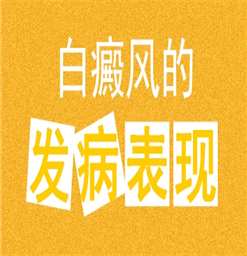 江苏什么白癜风医院比较好*哪几点因素能引发白斑