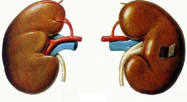 上眼皮肿是怎么消肿？