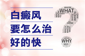 安庆较好的治疗白癜风医院#白癜风早康复，需要做到这“五不缺”！