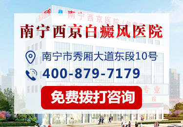 南宁医院治疗白癜风的有效方法