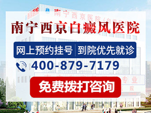 南宁哪家白癜风医院比较好
