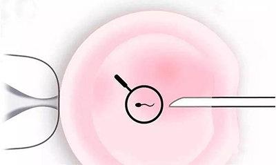 江苏省正规人工受孕价格可靠_试管婴儿费用
