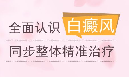 济宁看白癜风的医院哪家好