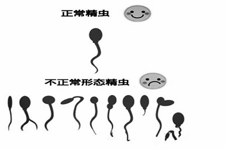 器质性早泄治疗预防