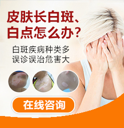 沧州治疗白癜风医院？挤压白癜风患处会变色吗？
