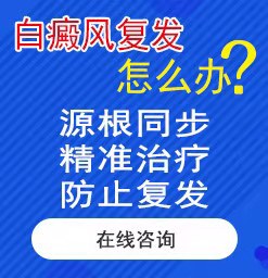 廊坊治疗白癜风要多少钱？为什么手上会出现白癜风？