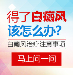 沧州治白癜风的医院？白癜风患者运动后有哪些禁忌？